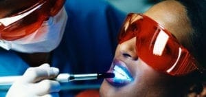 dental whitening
